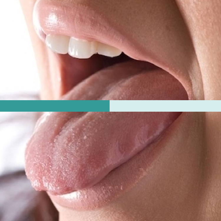 5 sencillas pautas para combatir el síndrome de la boca seca | Clínica Dental Zaragoza - Clínica Dental AG